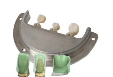 prefabricated crowns fully milled intraoral scan