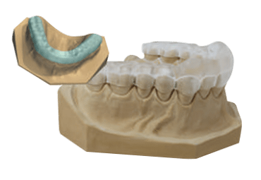therapeutic splints dental milling