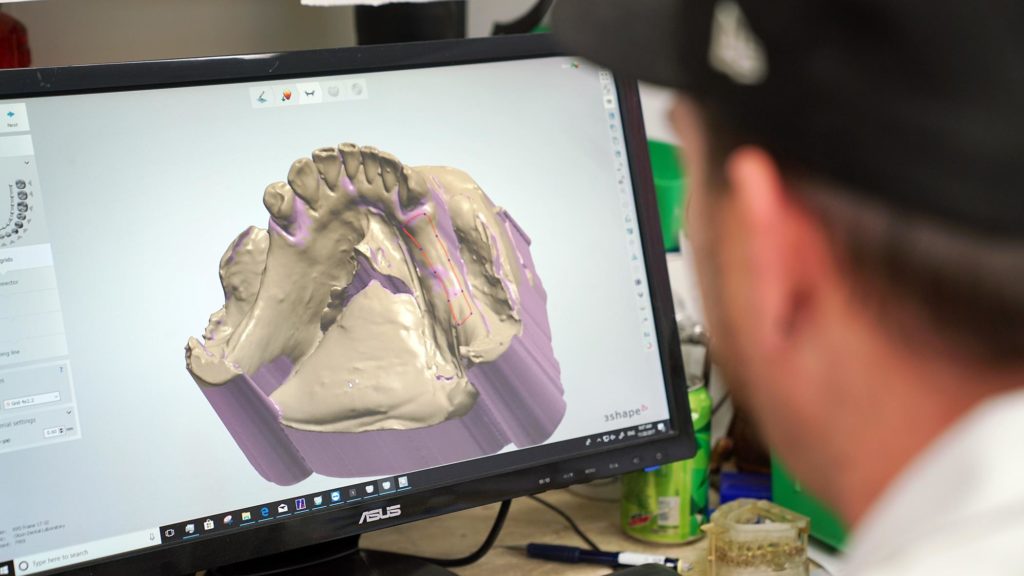 3D Printing solutions for dental ortho labs