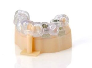 Stratasys Objet260 Dental Implantology
