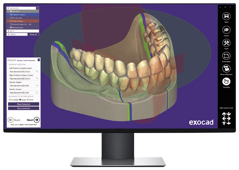 exocad dental CAD 3D design software