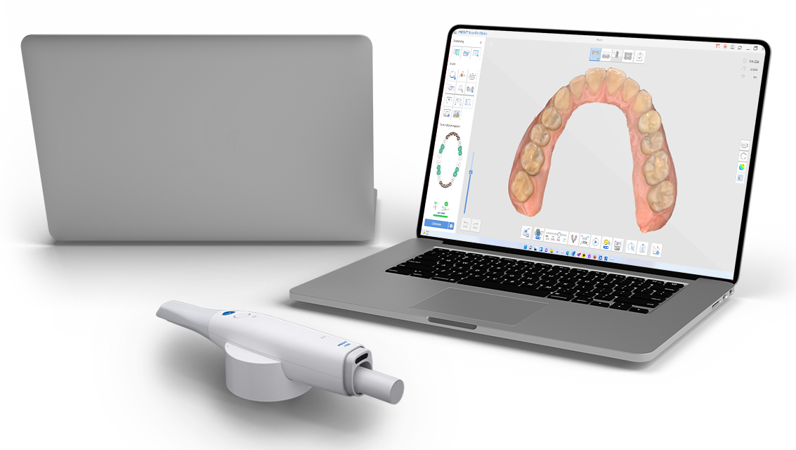 vigtigste Indtægter forfremmelse Medit i500 Intraoral 3D Scanner for Dental Clinics | Digital Dentistry