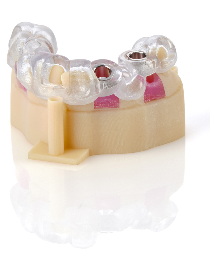 The Stratasys J5 DentaJet Dental 3D Printer | 3D Printing for Dental Labs