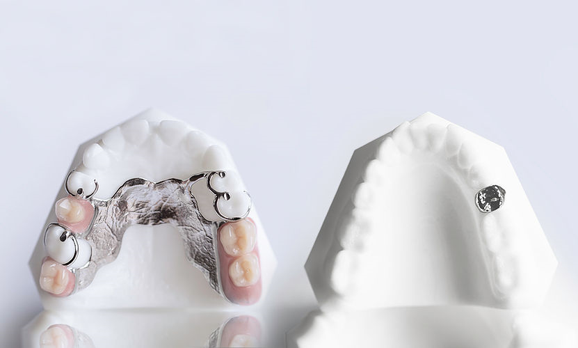 Dlyte dental compact series tile image 2 metal polishing and smoothing