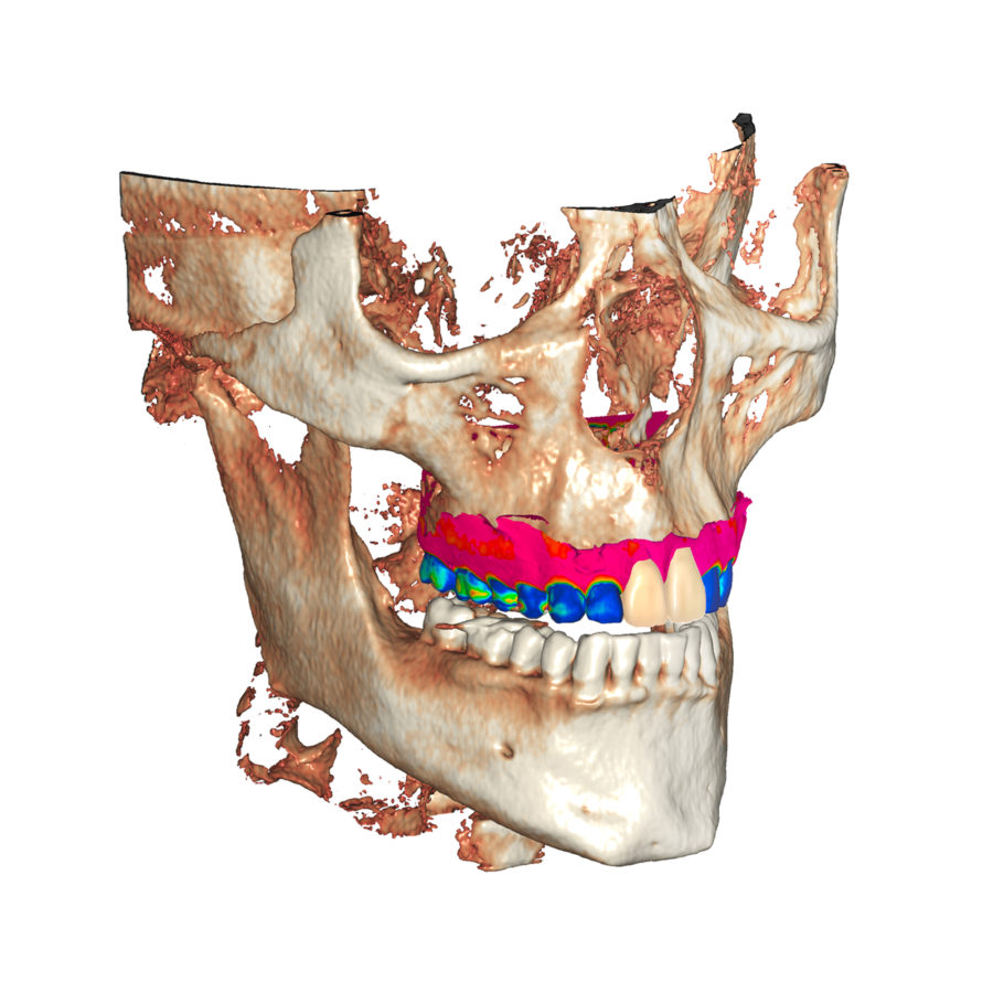 Proto3000 Dental | 3D Printers, Dental Mills, Dental 3D Scanners, CAD/CAM
