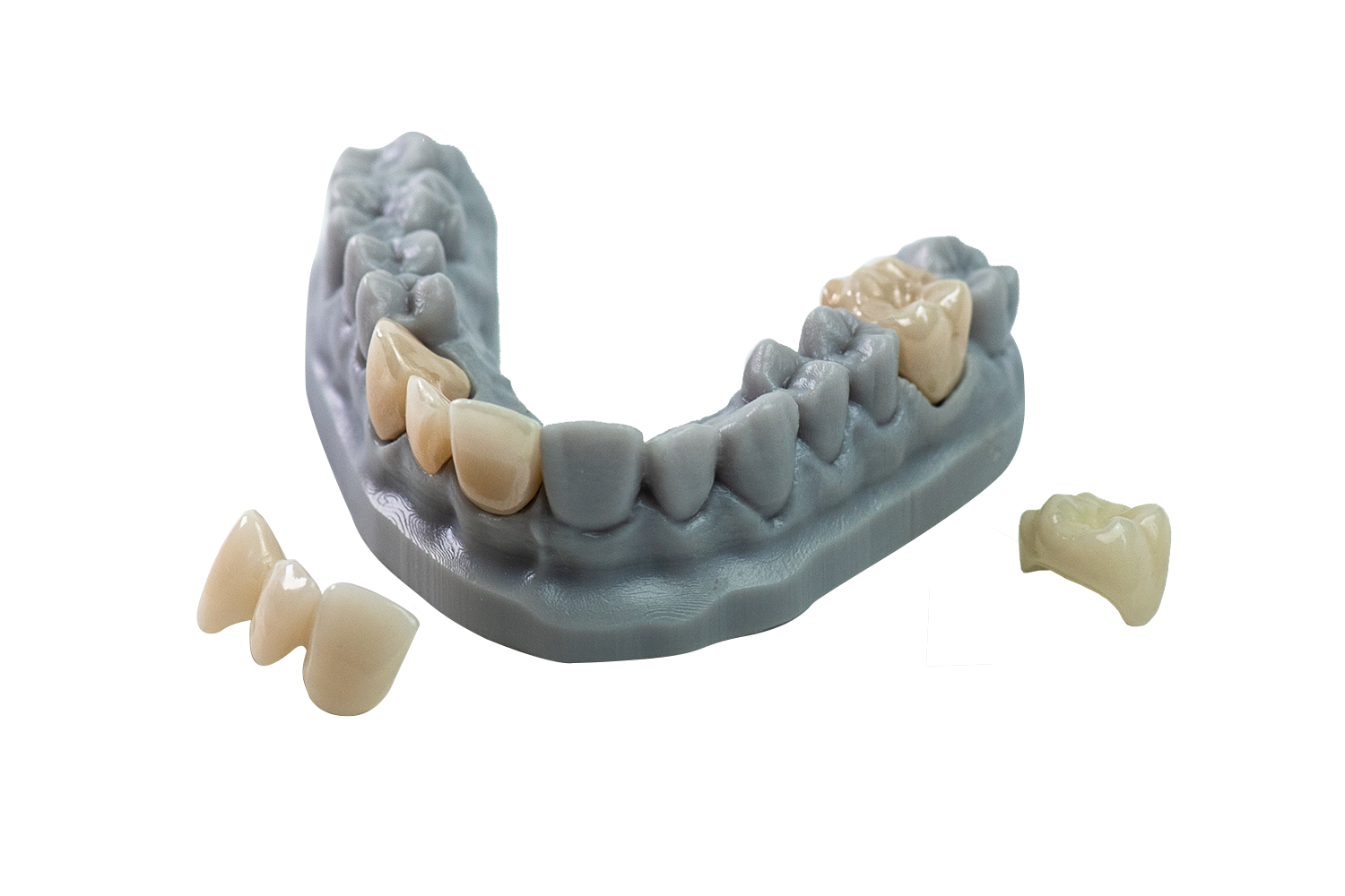 dental 3d printing milling applications fixed restorations
