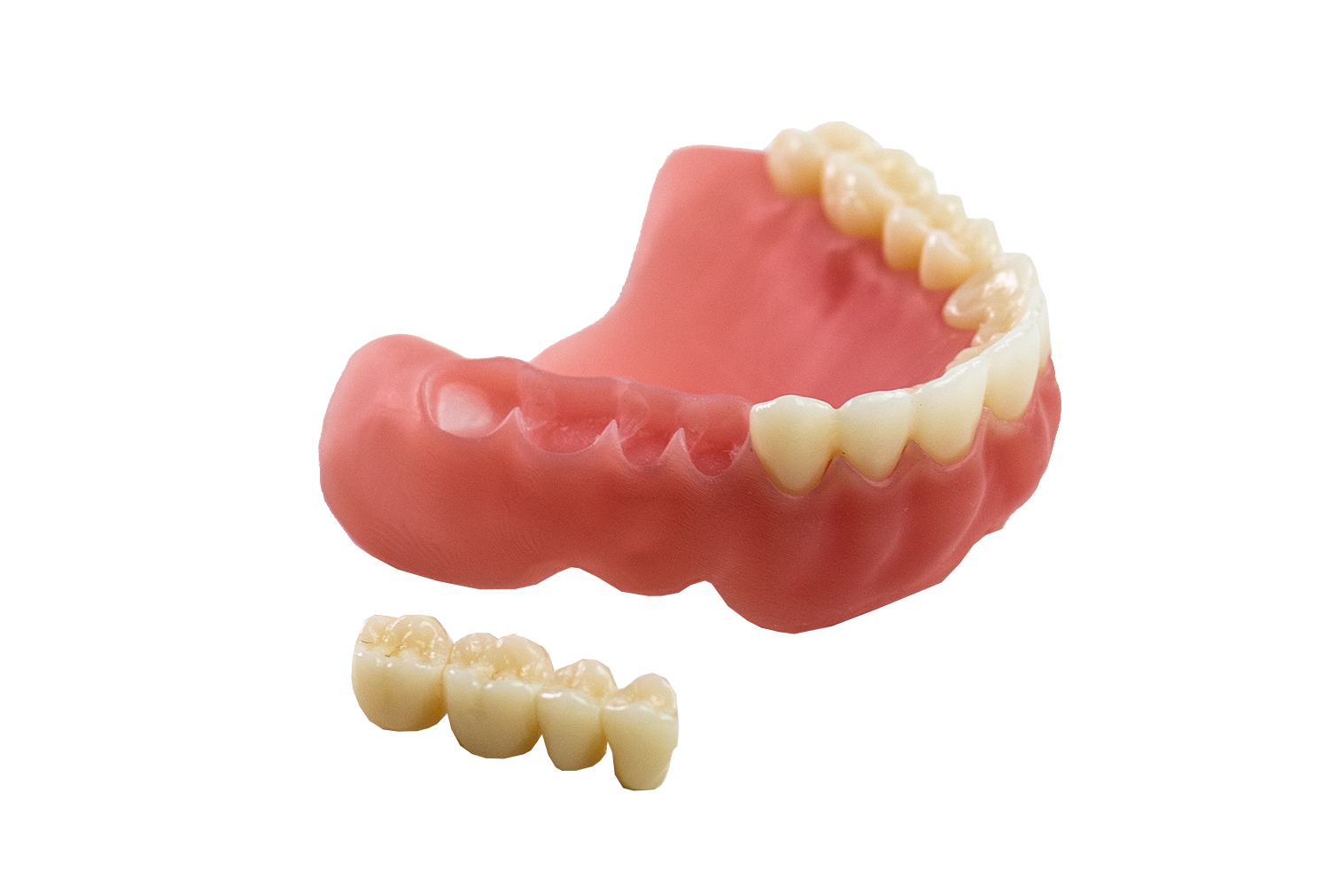 3d printed or milled digital dentures