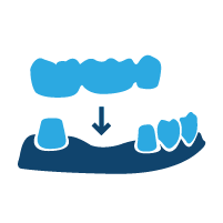 Proto3000_Crown Bridge icon