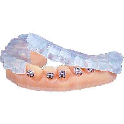 KeyPrint® KeyOrthoModel® 3D Printing Resin for Clear Aligner