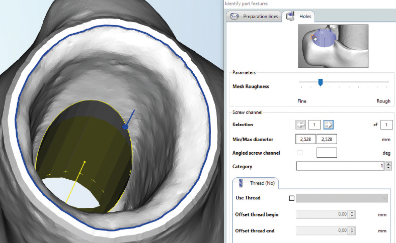 hyperDENT_holes