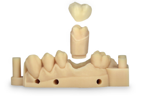einstein pro xl dental dlp 3D printer applications Dental crown and bridge quadrant models