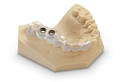 einstein pro xl dental dlp 3D printer applications implant surgical guides