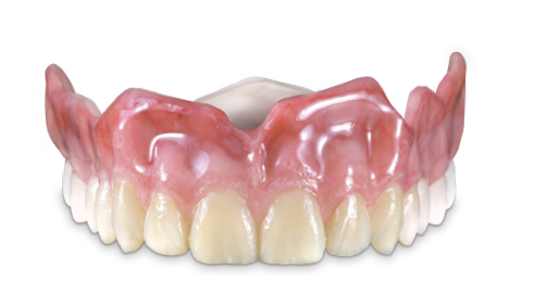 einstein pro xl dental dlp 3D printer applications monolithic and try in dentures