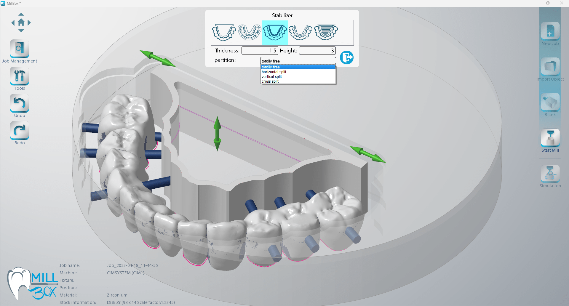 Image shows printscreen of connectors-stabilizers module within MillBox dental software