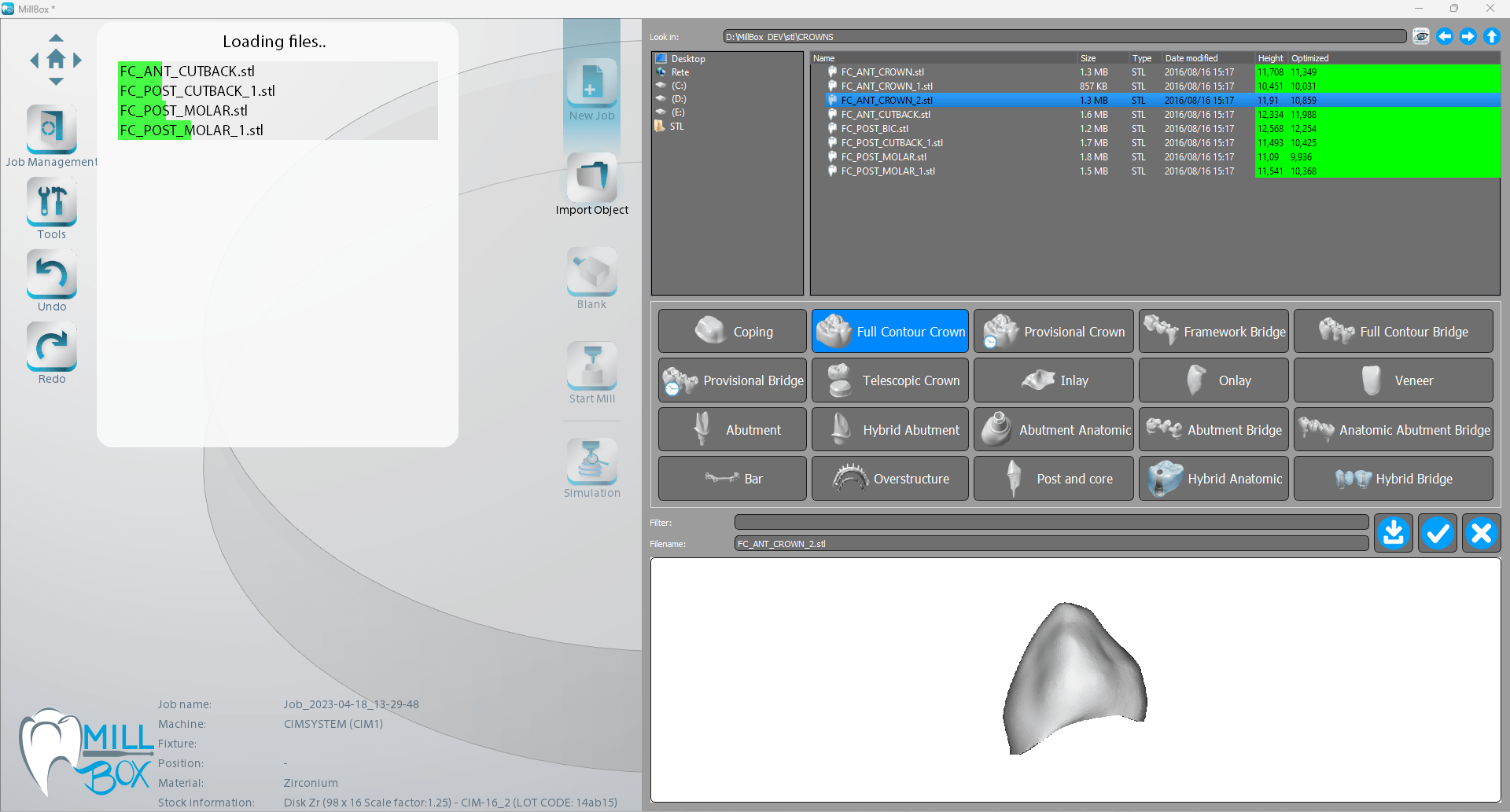 Image shows print screen of importing multiple STL files in MillBox dental software