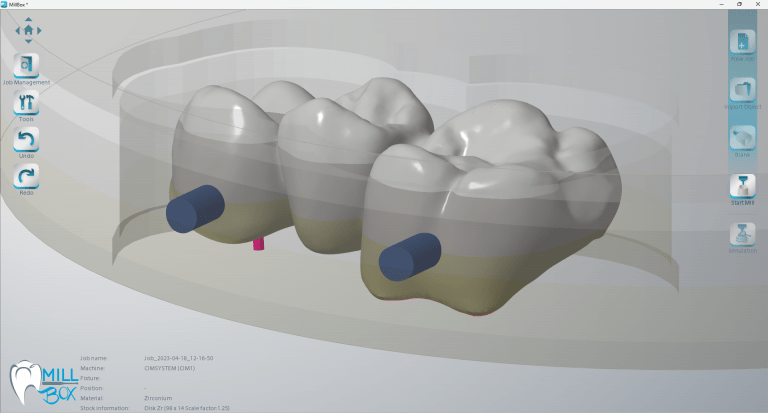 Image shows print screen of material multi-shaded layered module in millbox dental software