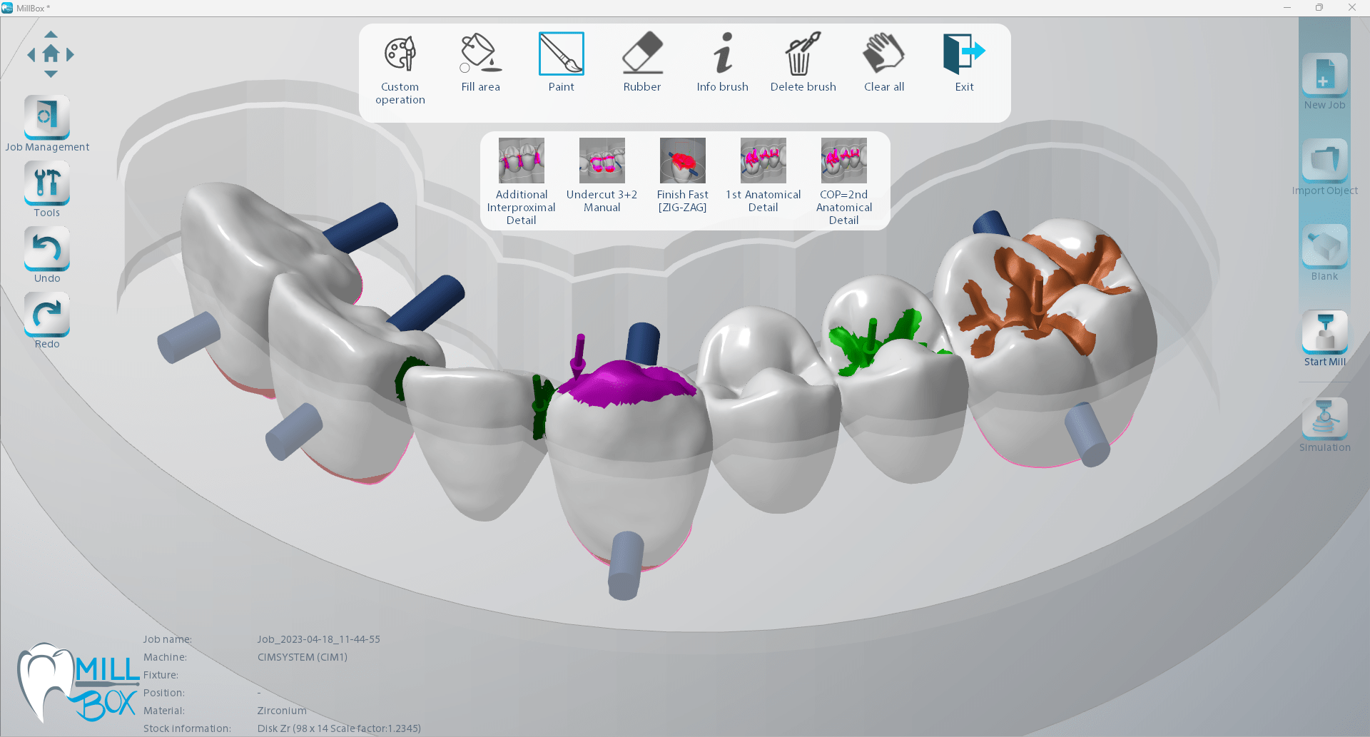 Image shows a print screen of selecting work area module in millbox dental software
