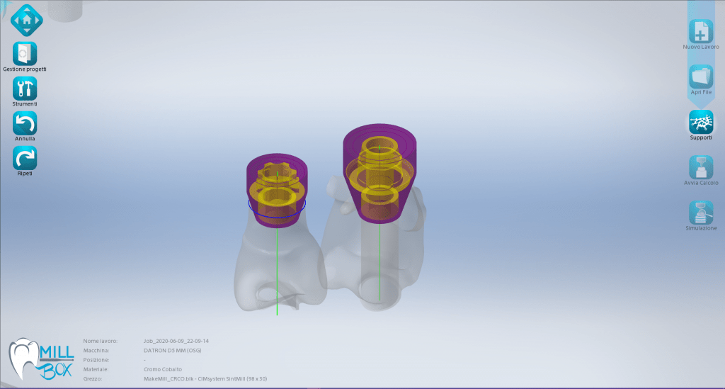 Image shows Make&Mill printscreen of automatic recognition of dental parts with an implant 