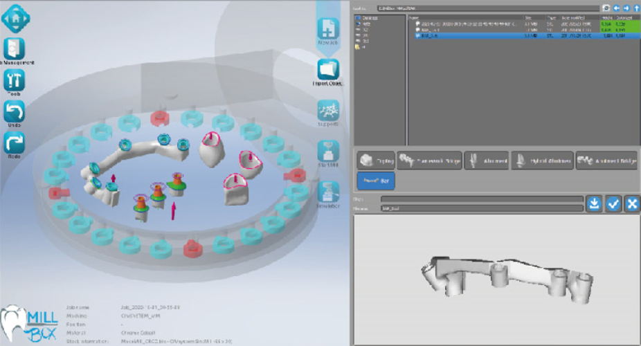 Image shows printscreen of Make&Mill software for importing dental restorations