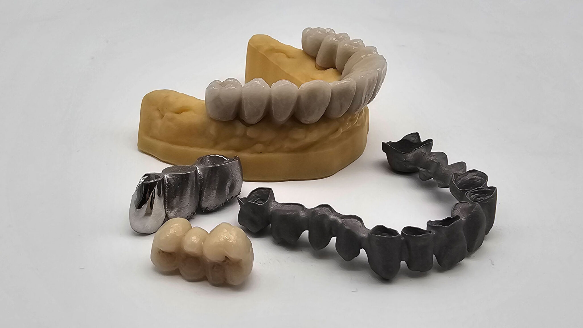 Image shows dental crowns and bridges by 2oneLab