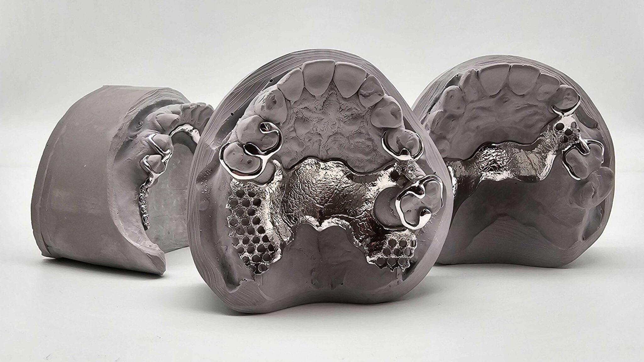 Image shows 3D printed dental partial frames 