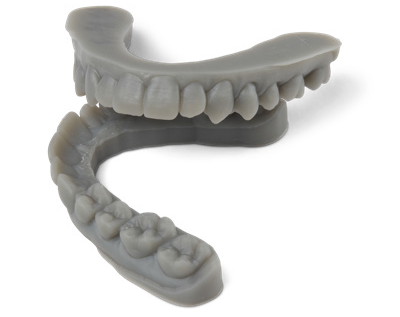 Image shows 3D printed clear aligner made with Formlabs Form 4B 3D printer