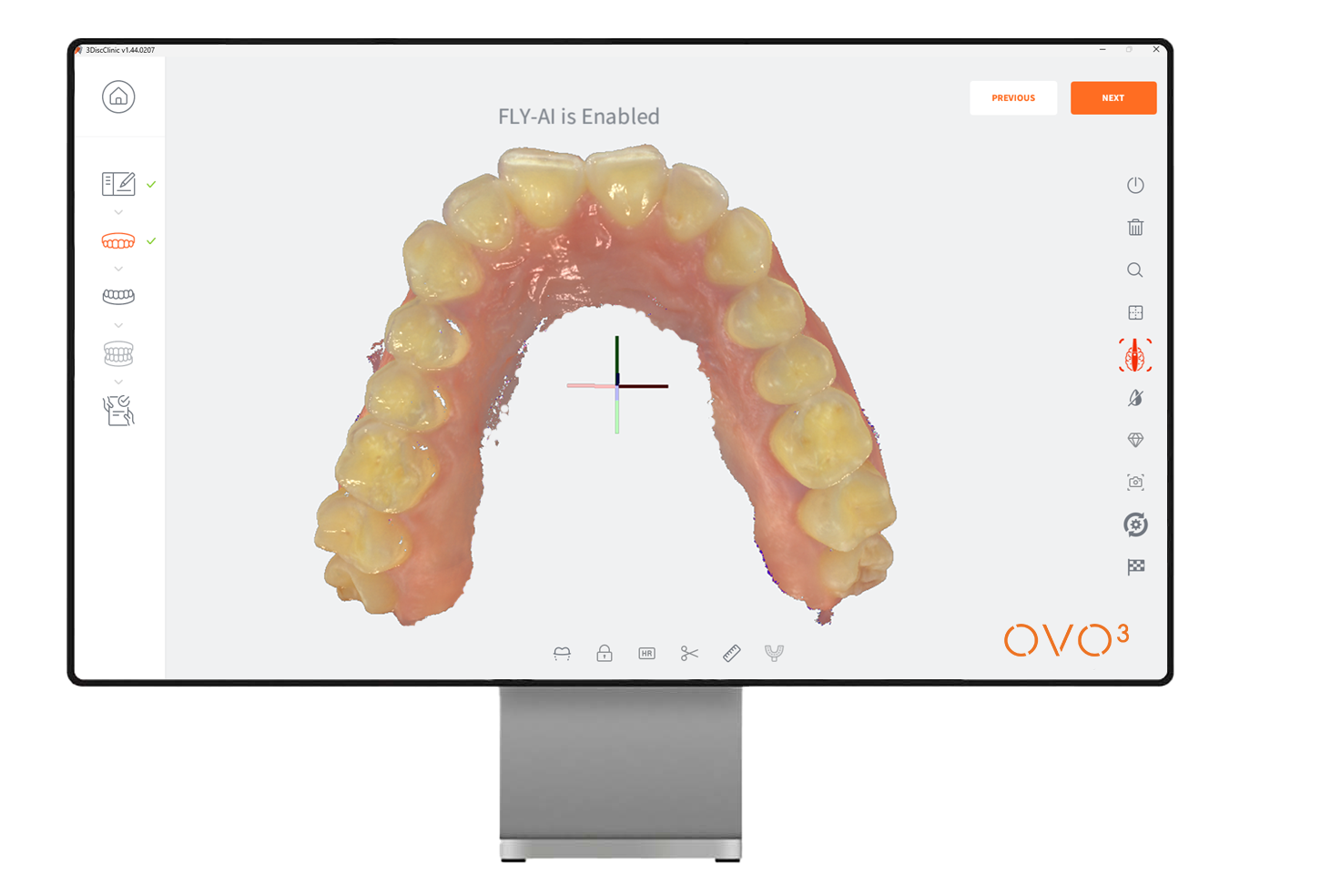 Image of OVO3 intraoral scanning on a monitor