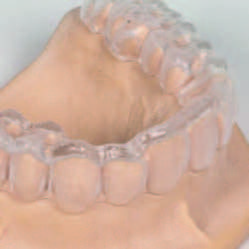 Image of a milled dental therapeutic splint