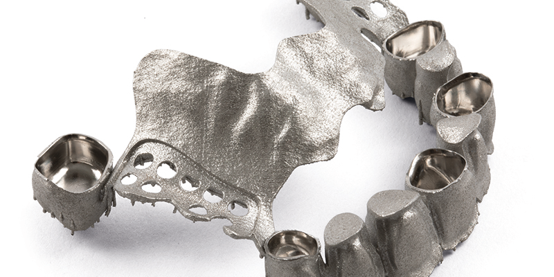 image of printed and milled metal dental frameworks