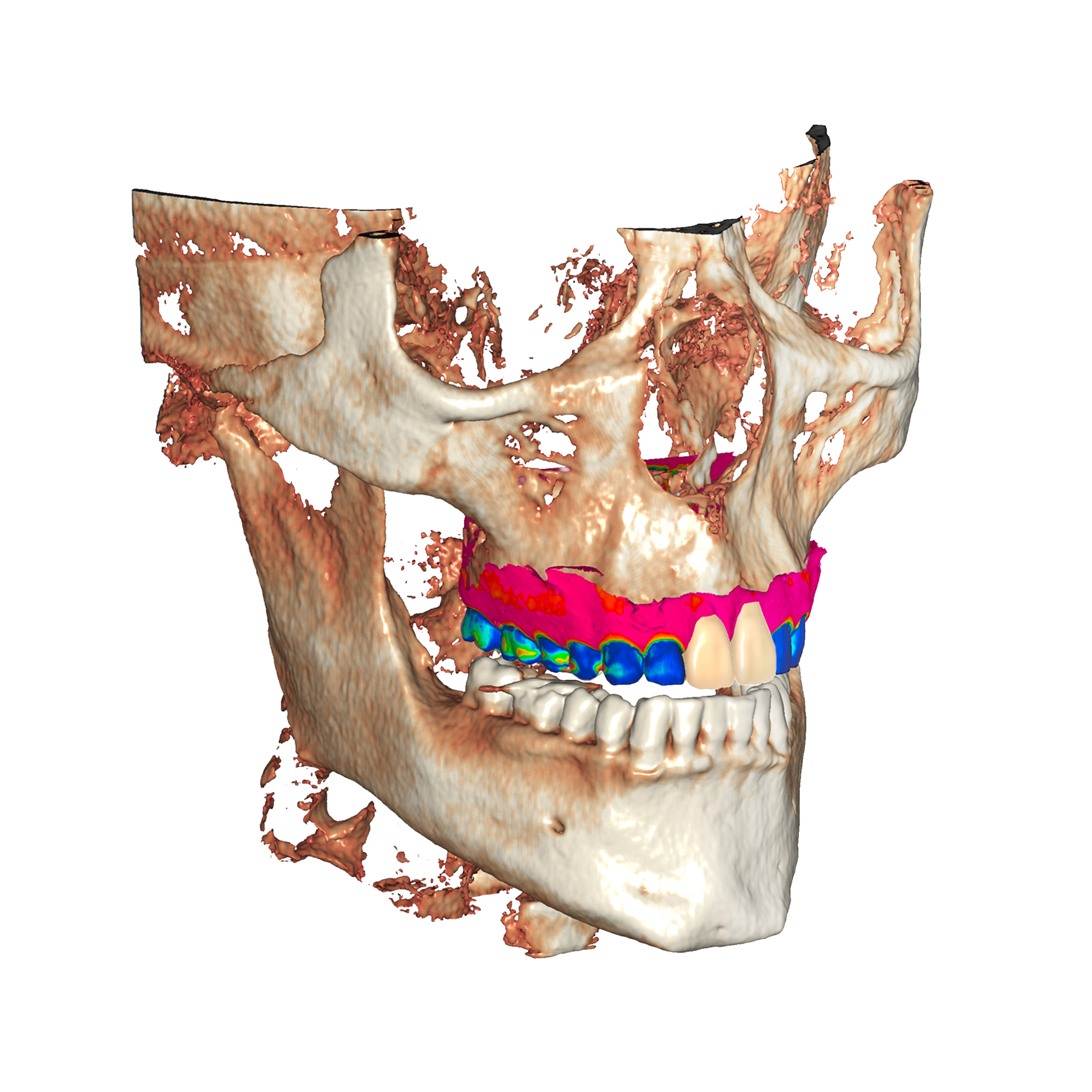 treatment planning and surgical simulation